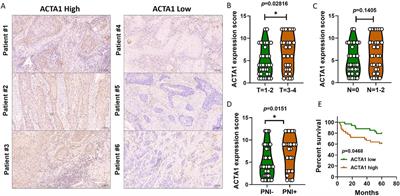 Integrating clinical and genomic landscape analysis of perineural invasion identify ACTA1 as an oncogene for oral squamous cell carcinoma